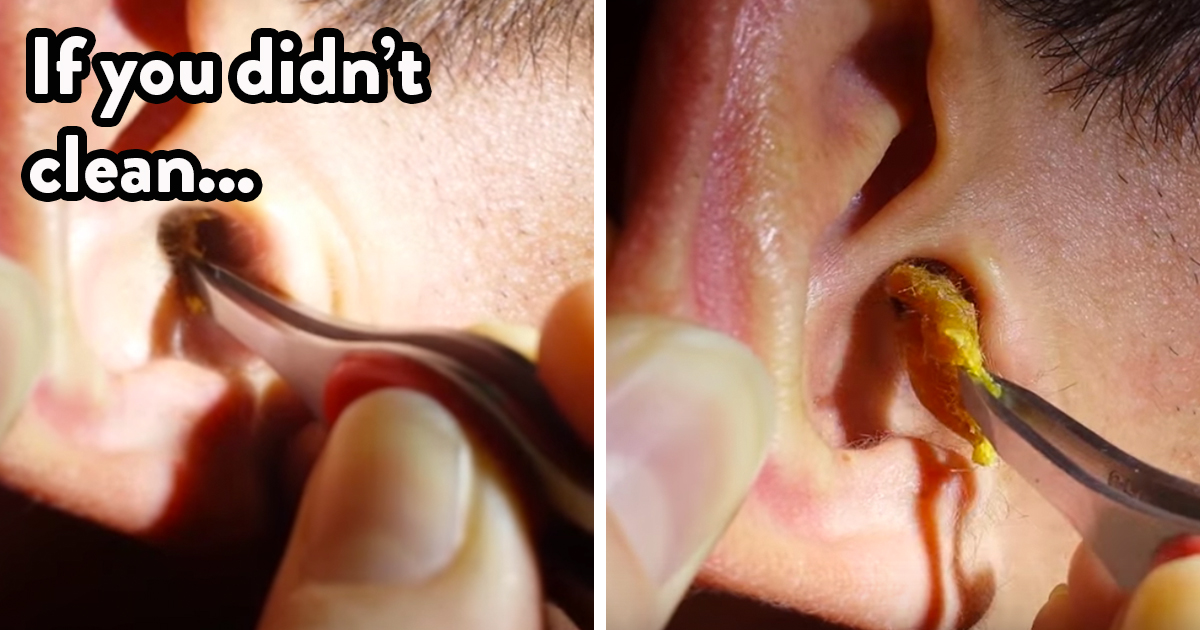 When To Clean Out Earwax Attn - Diy Ear Wax Removal At Home
